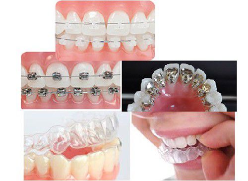 Gia công cnc trong Y tế